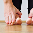 Splay Foot Symptoms And Treatment Exercises